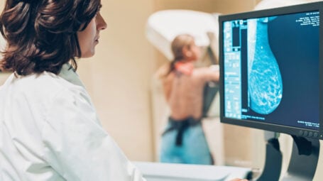 Arriva la mammografia intelligente, meno dolorosa e con meno radiazioni